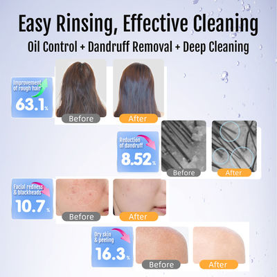 Luxuriöser Blasen-Generator aus Messing & Edelstahl | Ultrafeine Duschwasserreinigung